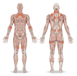Anatomie van de spieren in het menselijk lichaam